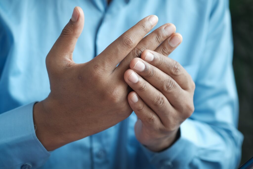 Close up of hands of person with arthritis.