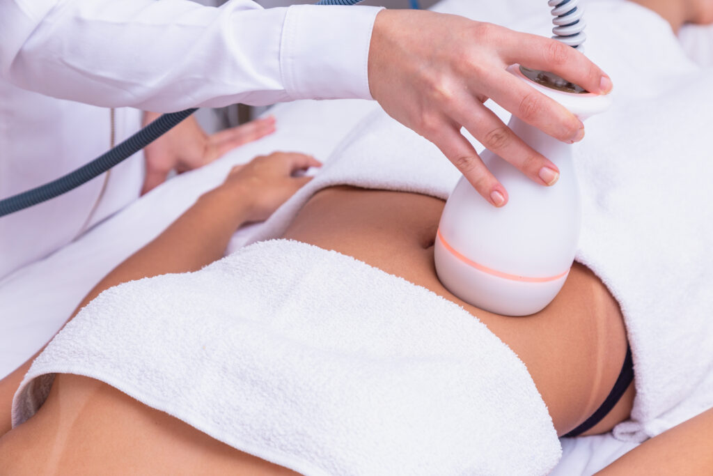 Woman receiving a laser fat removal procedure in a clinic