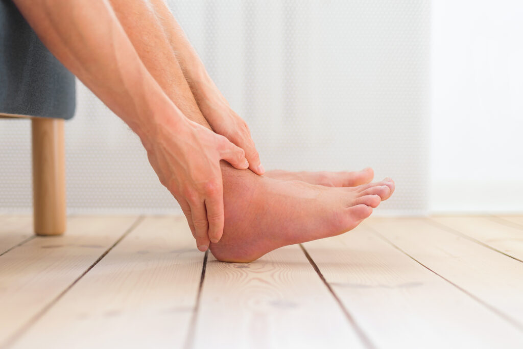 Person holding a swollen ankle due to angioedema