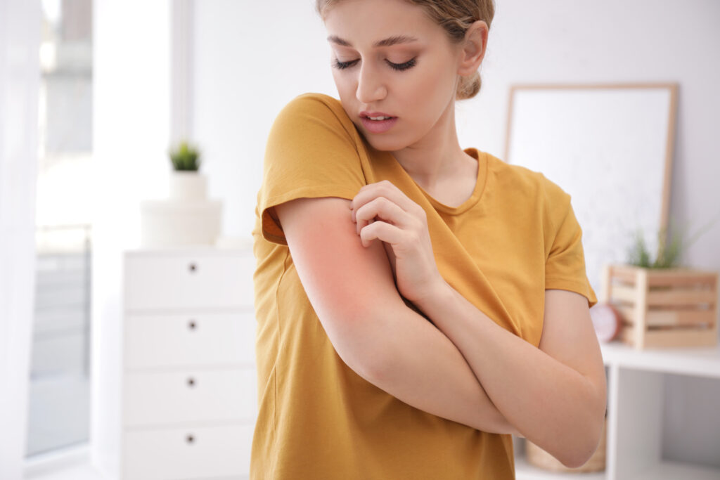 Woman scratching skin rash on her arm.